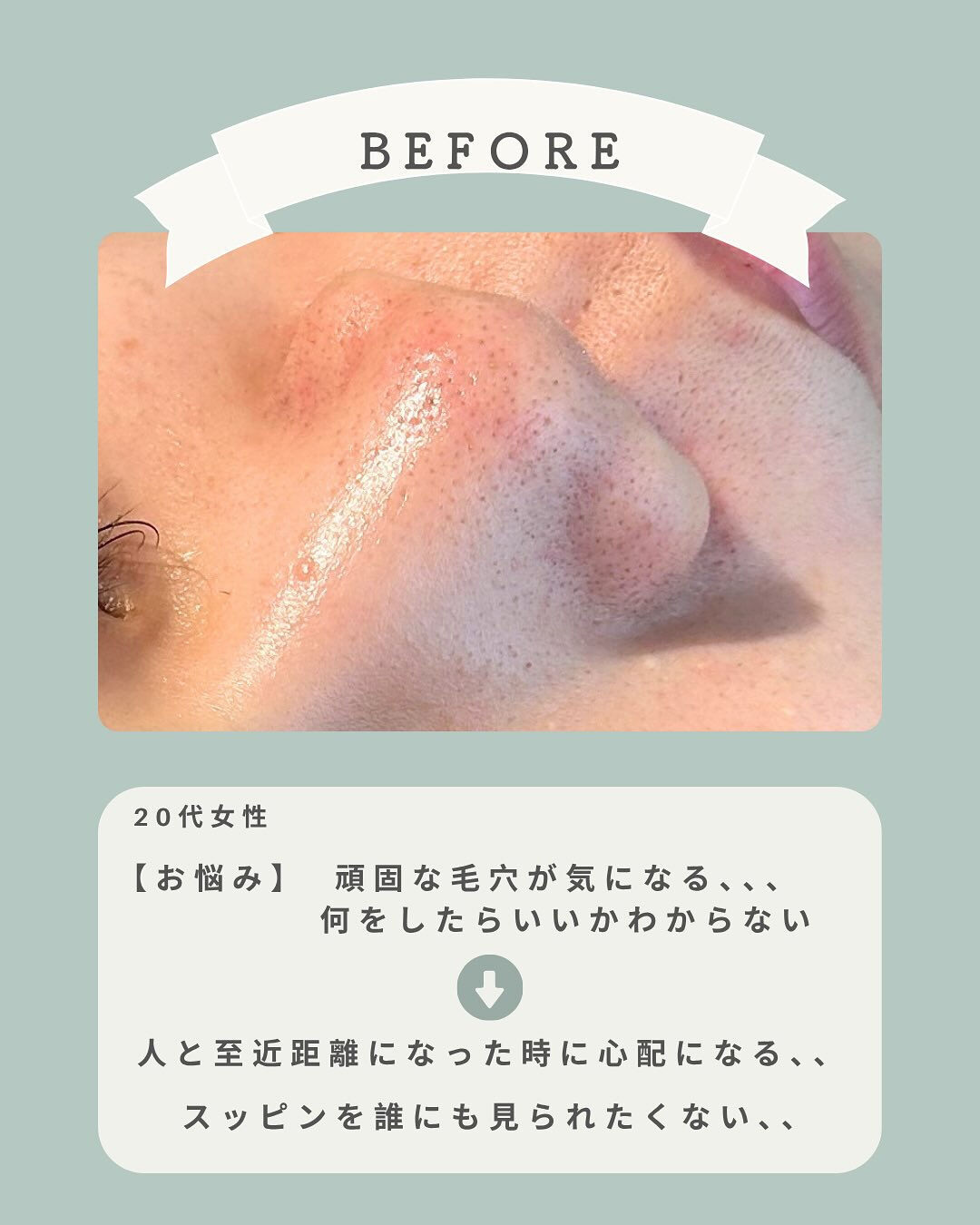 ＼手強い毛穴悩みにもアプローチ💪🏻✨／