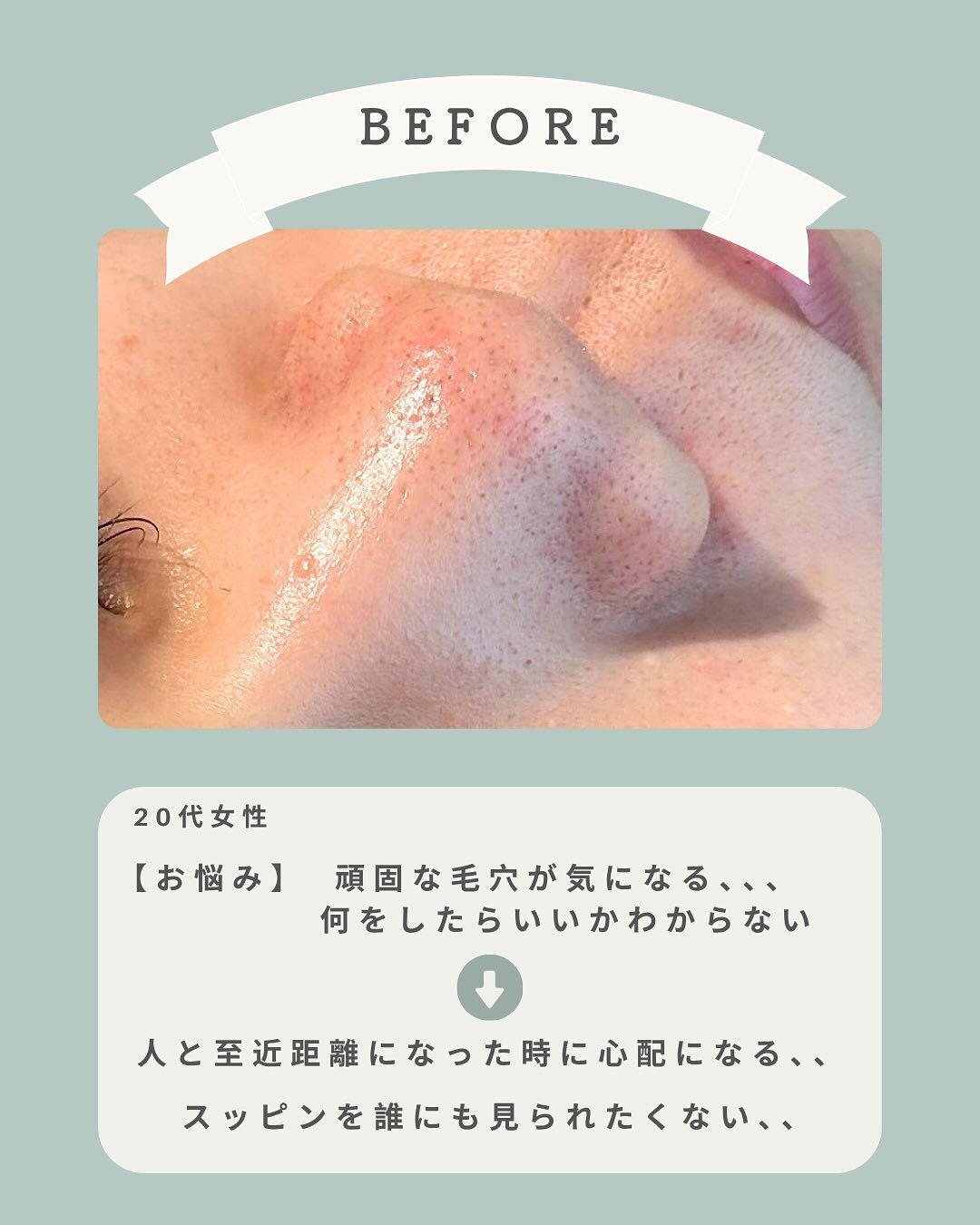 ＼手強い毛穴悩みにもアプローチ💪🏻✨／