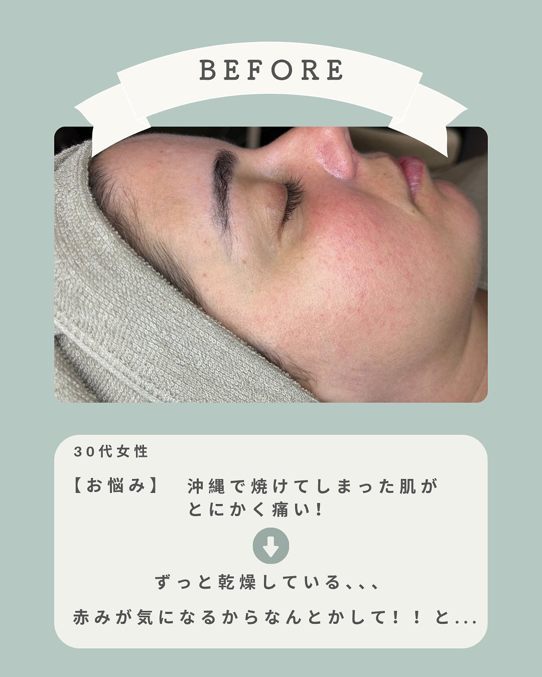 ＼ダメージを受けたお肌のリセットには✨／