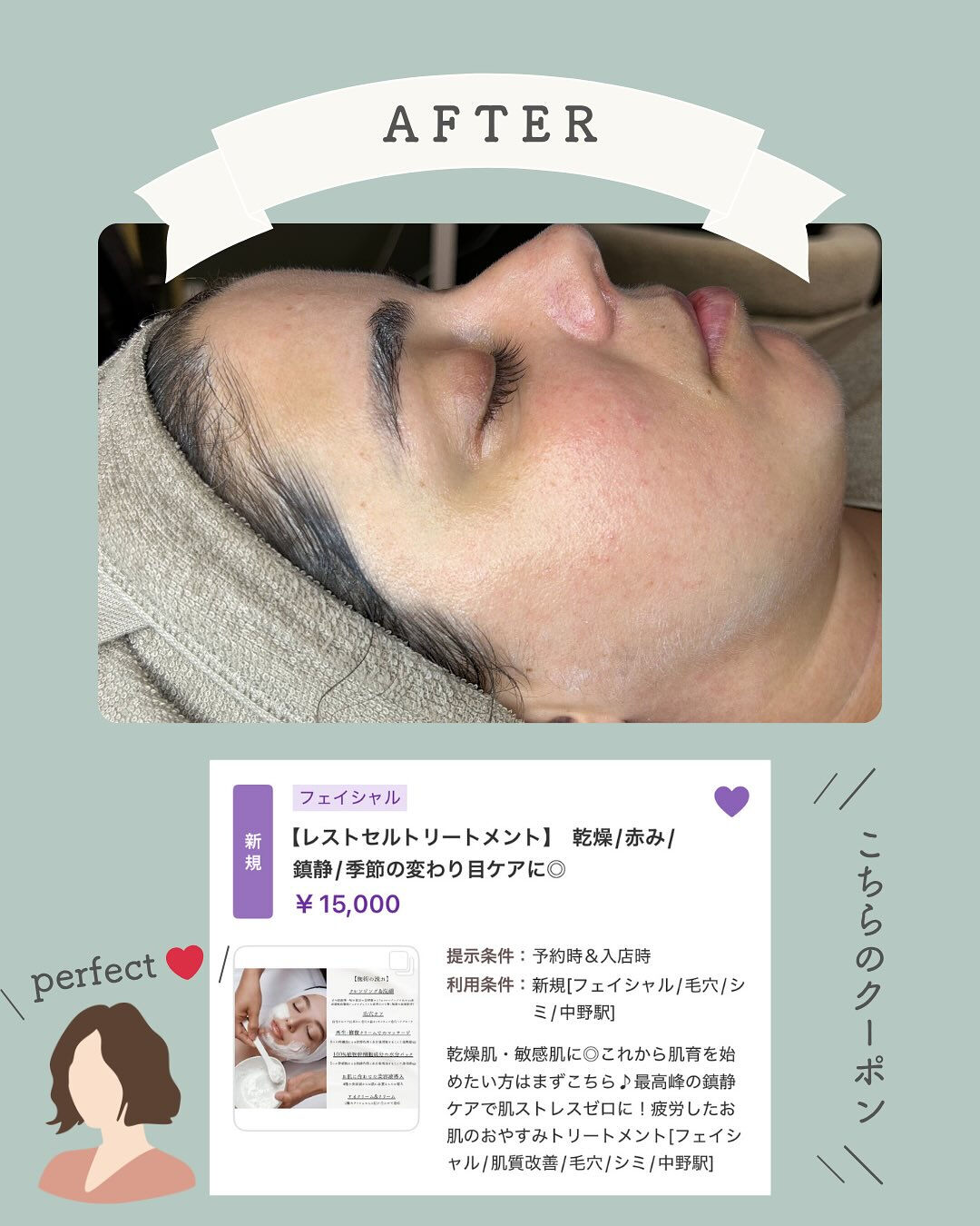 ＼ダメージを受けたお肌のリセットには✨／
