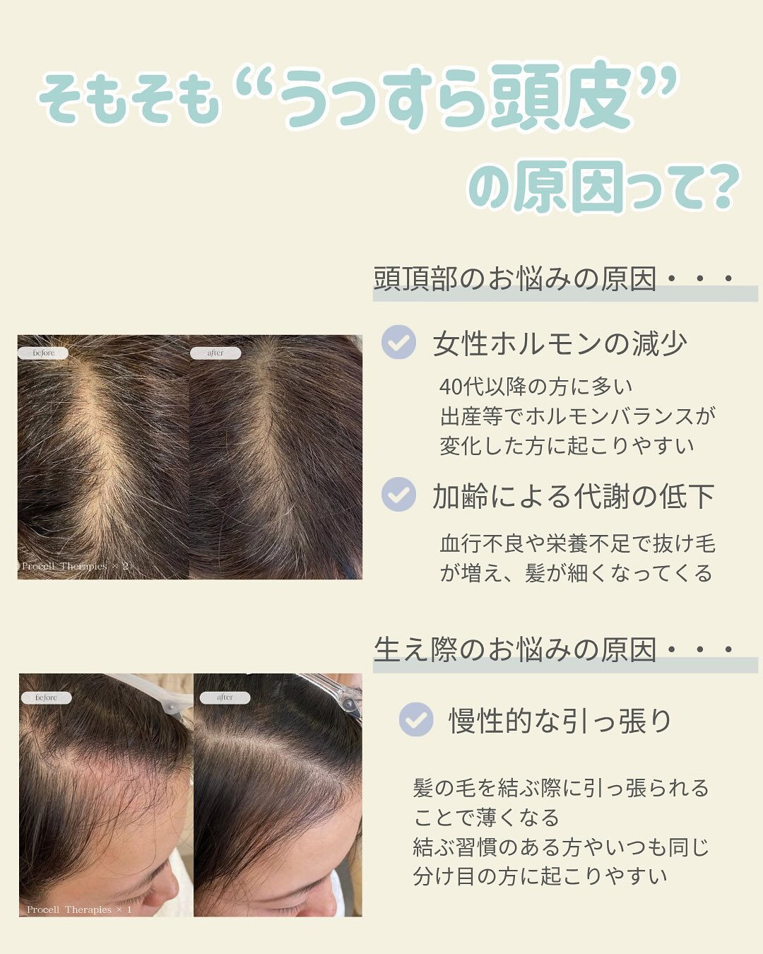 ＼自分の髪の毛を育てる！？／