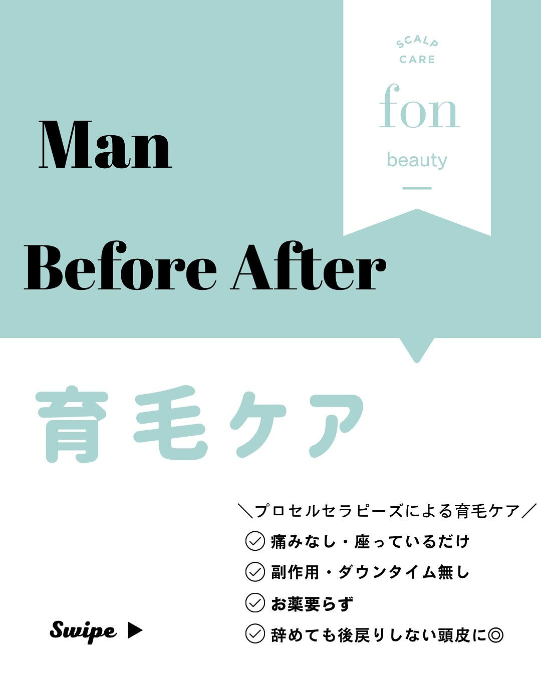 ＼男性の育毛ケア　症例写真／