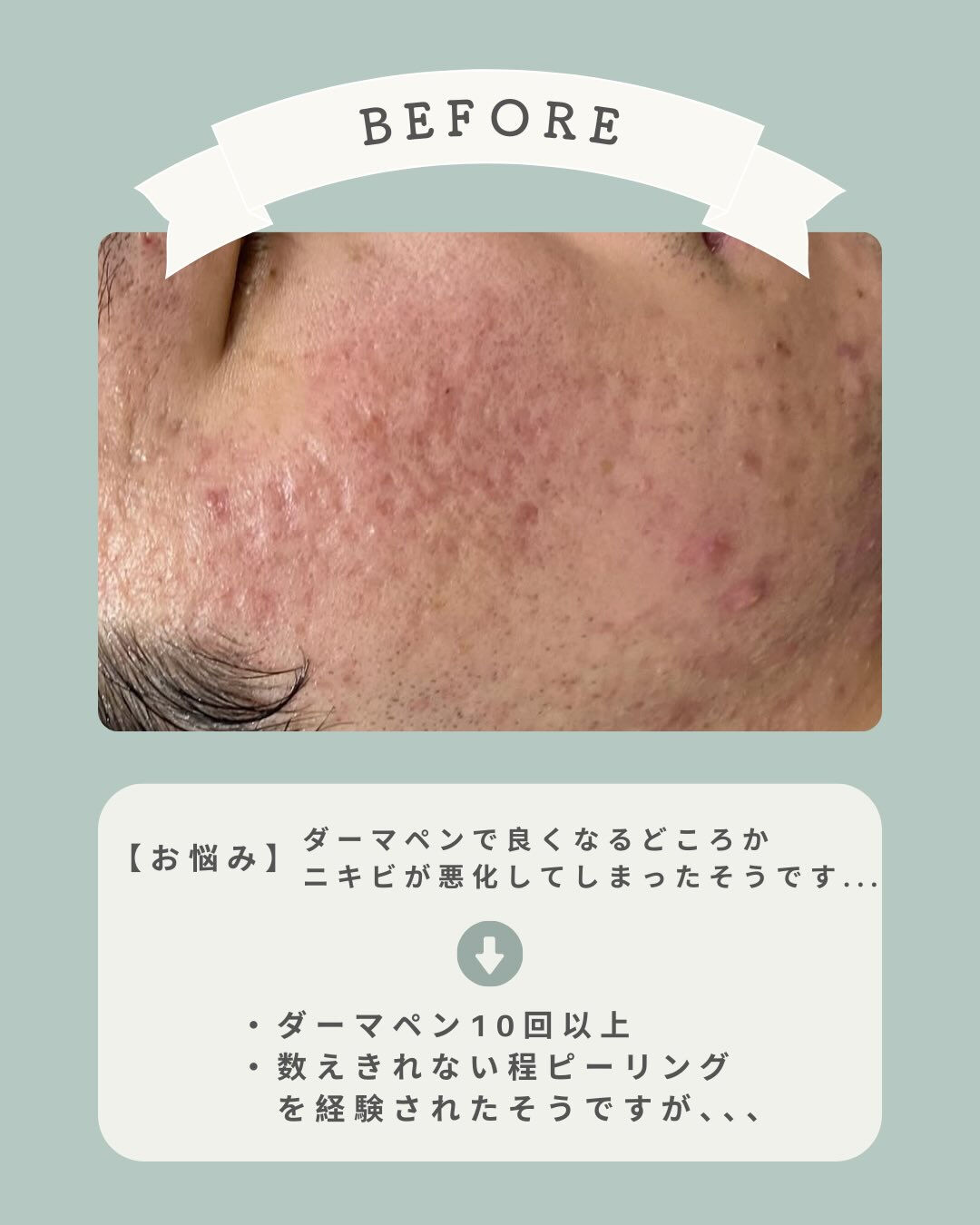 - ̗̀ fon beautyの細胞から変える肌質改善♡ ‪
