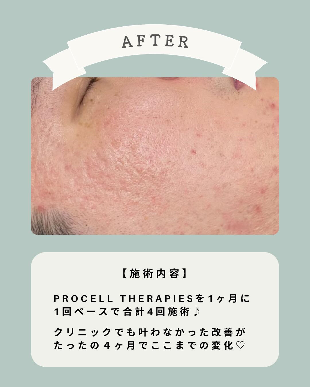 - ̗̀ fon beautyの細胞から変える肌質改善♡ ‪