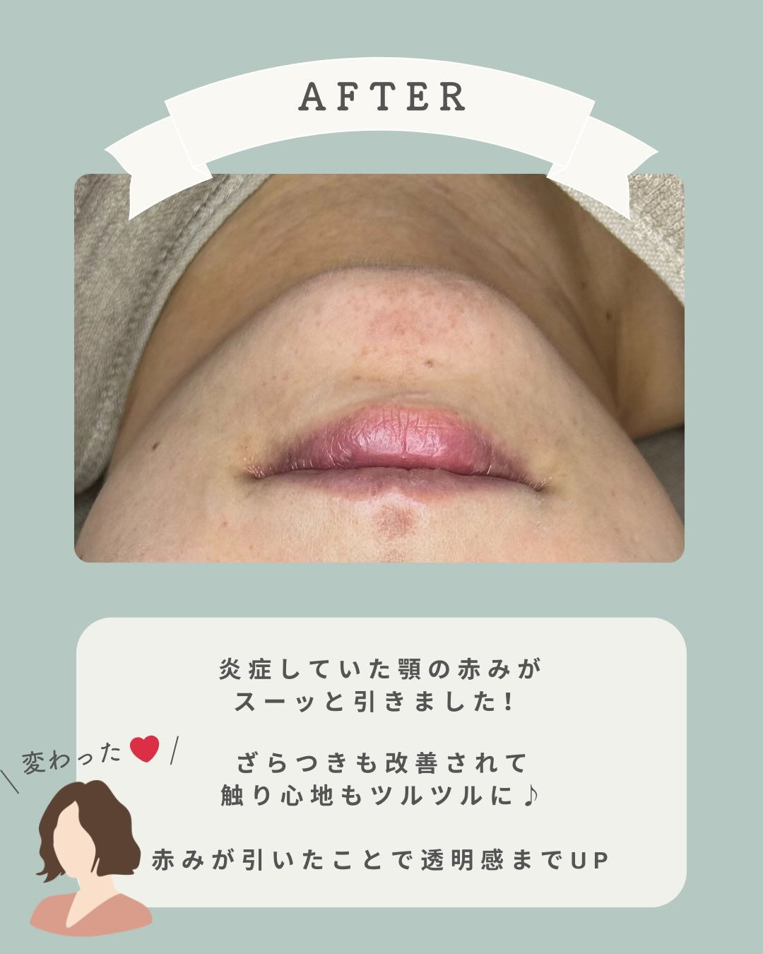 - ̗̀ お客様の経過写真♡ ‪ ̖́-‬