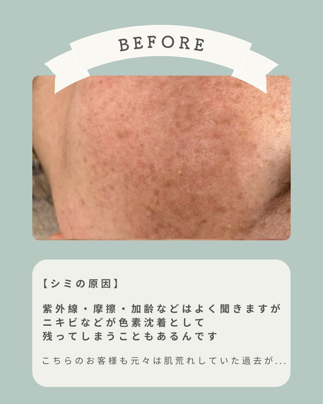 - ̗̀ お客様の症例写真♡ ‪ ̖́-‬