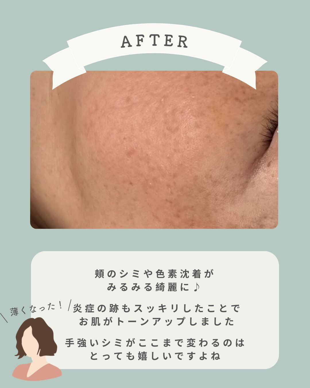 - ̗̀ お客様の症例写真♡ ‪ ̖́-‬