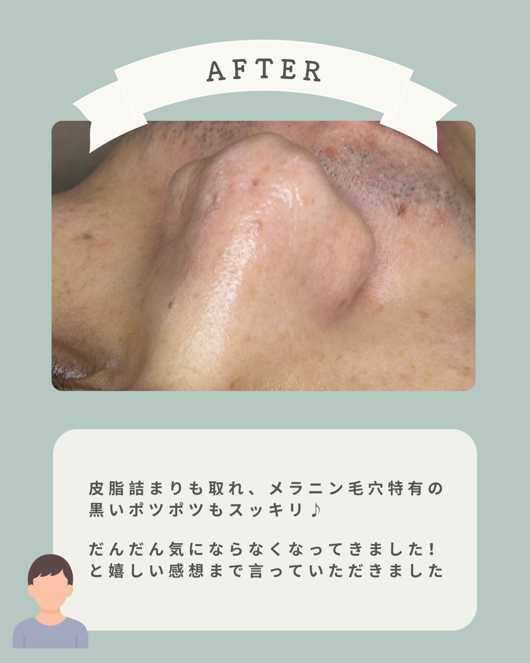 ＼手強い毛穴悩みにもアプローチ💪🏻✨／