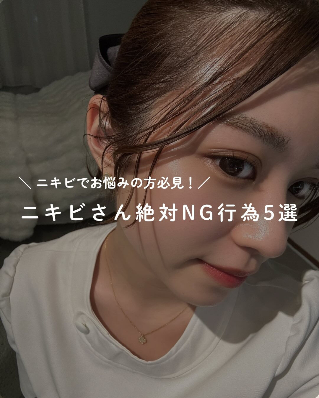 ＼ニキビでお悩みの方必見💡／