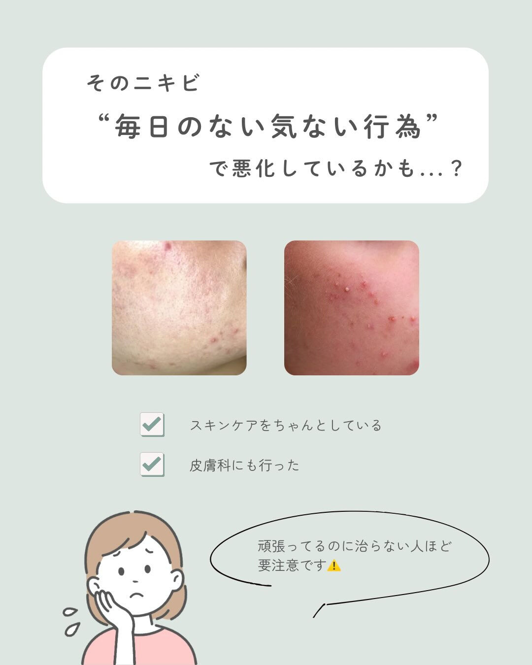 ＼ニキビでお悩みの方必見💡／