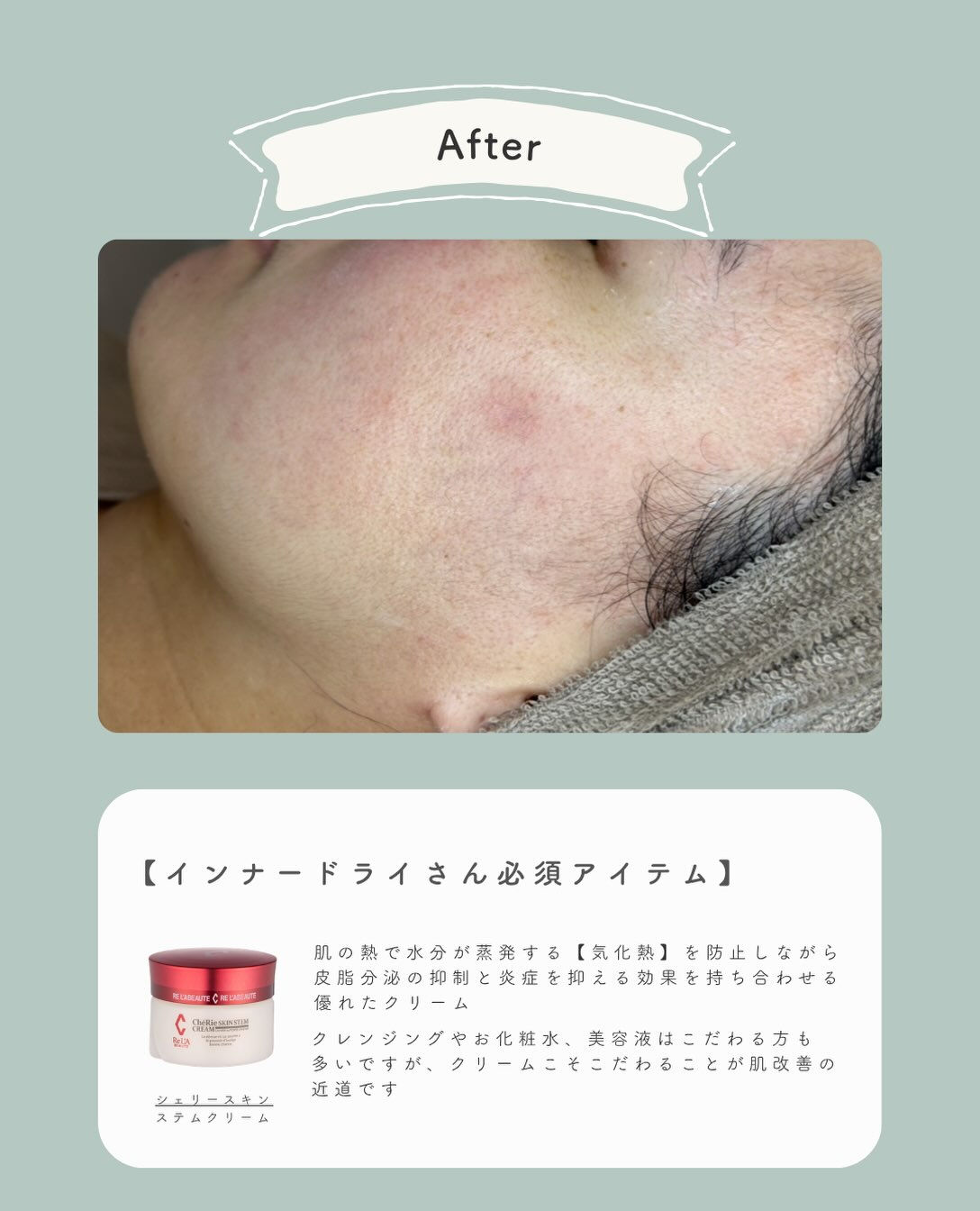 - ̗̀ お客様の症例写真♡ ‪ ̖́-‬